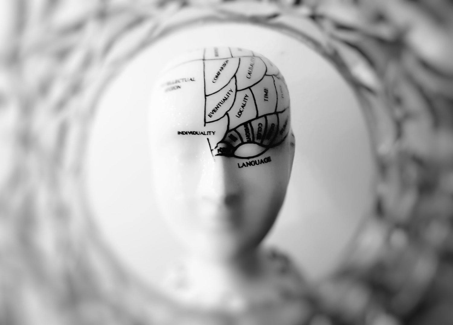 Vestibular Migraine