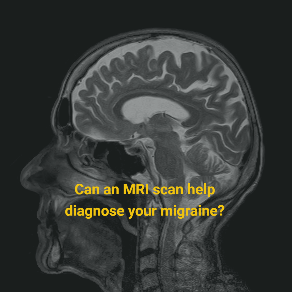 Can an MRI Scan Diagnose Your Migraine?